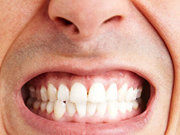 Tìm hiểu về tất nghiến răng, nguyên nhân và cách điều trị