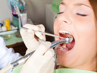 Cạo vôi răng có đau không bác sĩ, chi phí là bao nhiêu?