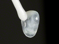 Hỏi về dịch vụ dán răng sứ Veneers cho răng bị nhiễm tetracyclin.