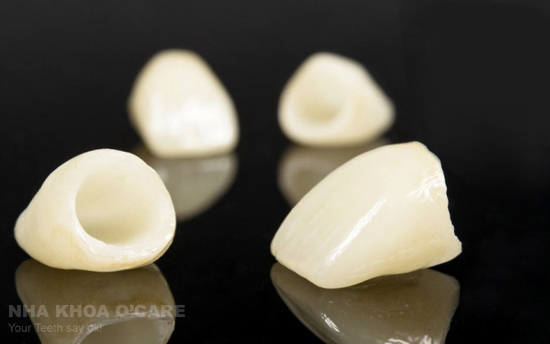 Răng sứ có những loại nào, chất lượng độ bền ra sao?