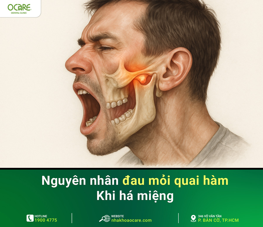 nguyên nhân đau quai hàm khi há miệng 900
