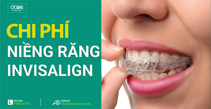 niềng răng invisalign giá bao nhiêu
