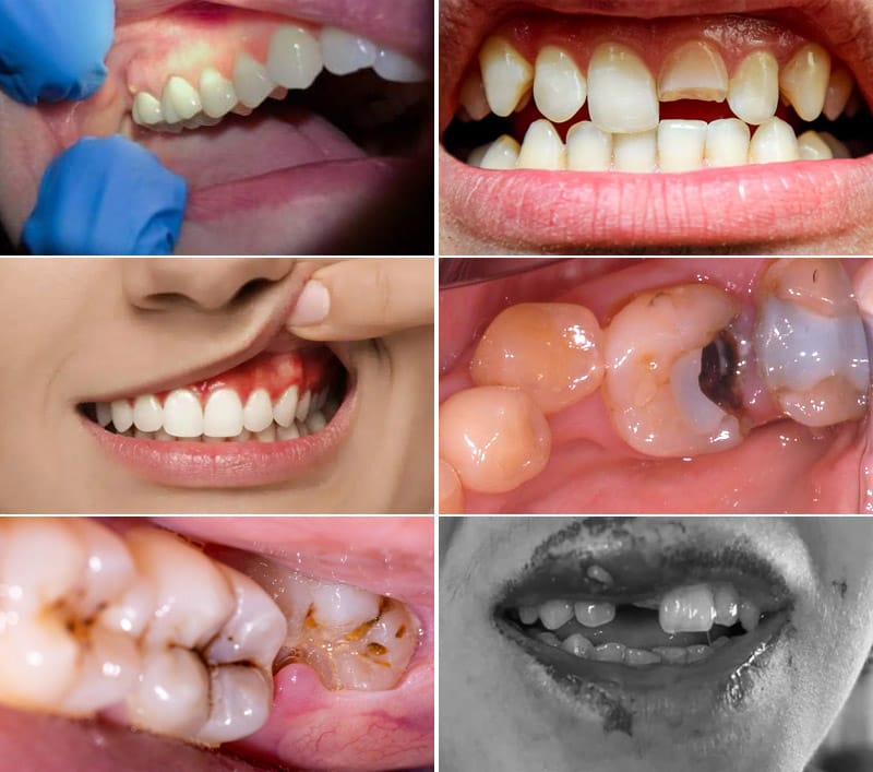 Emergency Dentist in Ho Chi Minh aaa