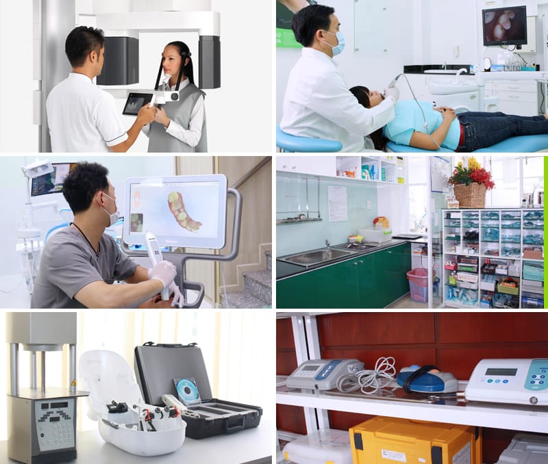 nha khoa ocare có tốt không a