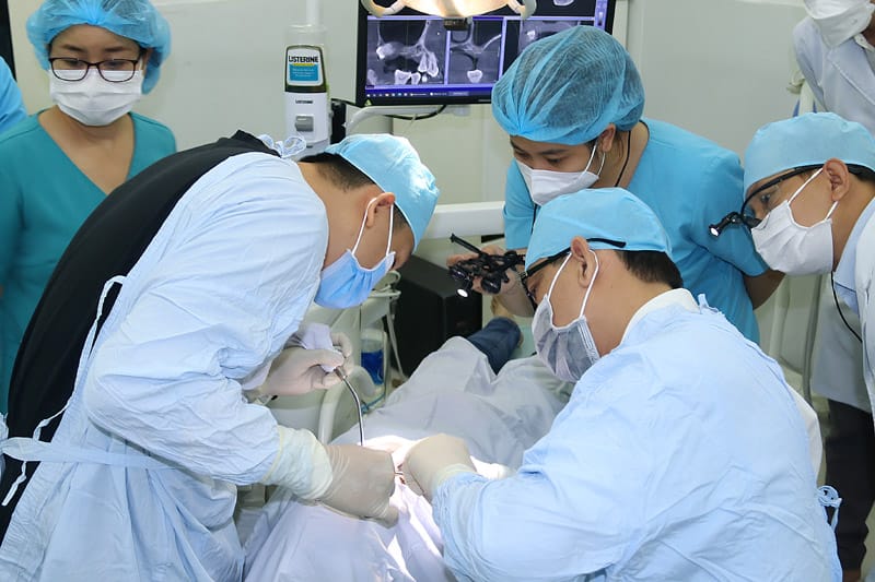 Phẫu thuật thông tuyến nước bọt