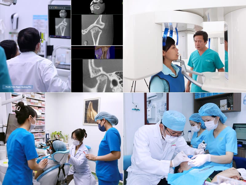 Điều trị khớp thái dương hàm tại nha khoa ocare