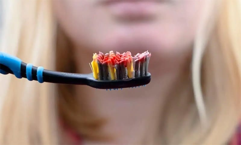 chai răng sai cách gây cháy máu chân răng