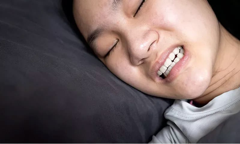 nghiến răng gây đau khớp thái dương hàm