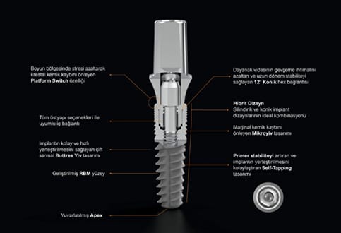 implant độ bền cao