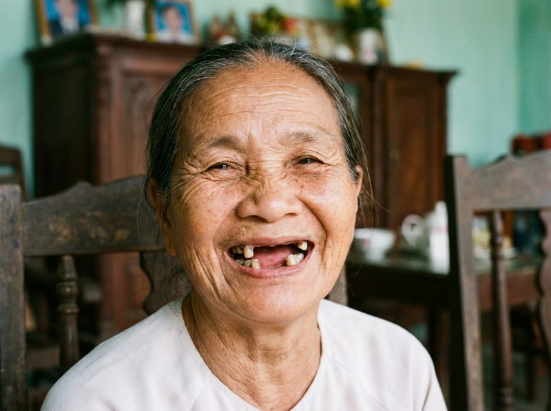 người già mất răng