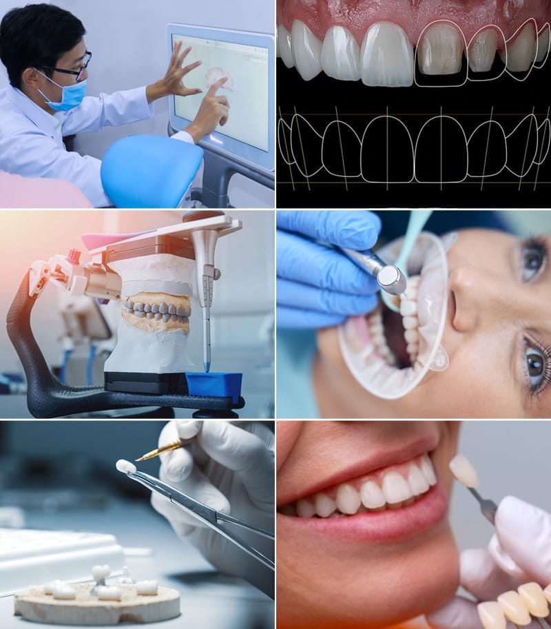 tư vấn bọc răng sứ giá bao nhiêu 3