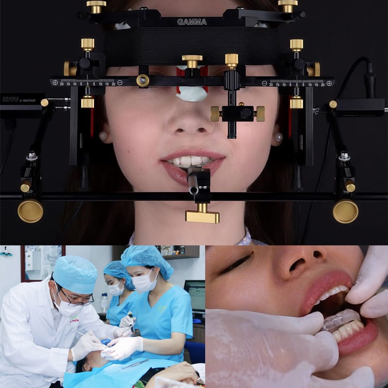 International Standard Specialized TMJ Treatment at Ocare Dental.