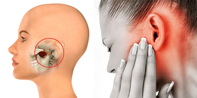 TMJ Disorder Treatment in Ho Chi Minh City