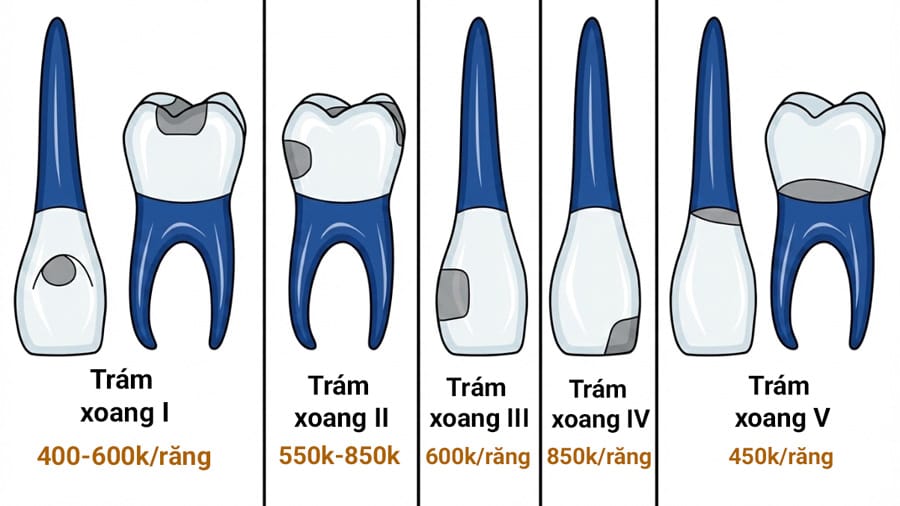 giá trám răng sâu