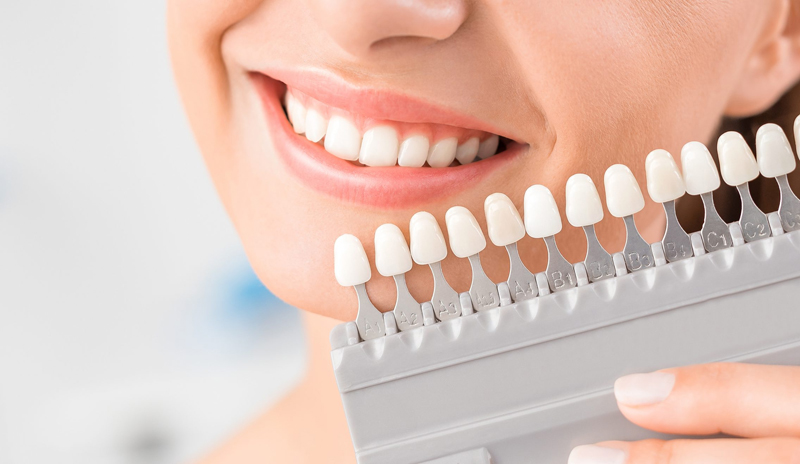 Teeth Whitening Ho Chi Minh City