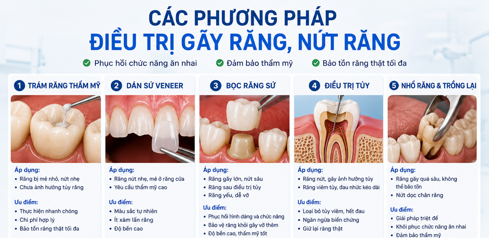 các phương pháp điều trị răng nứt gãy
