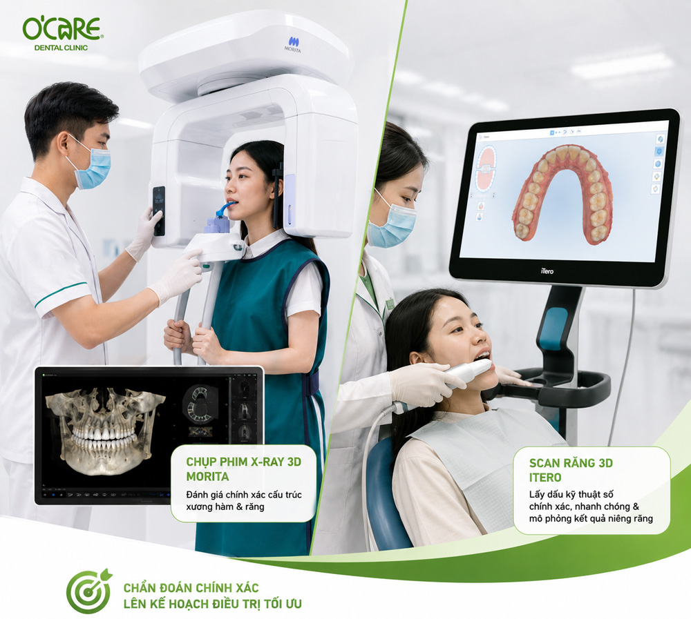 chụp xquang và scan răng 3d tại nha khoa Ocare