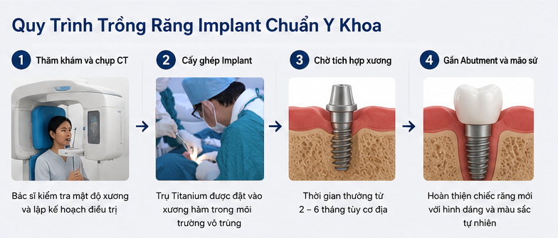 quy trinh cấy ghép implant tại nha hhoa uy tín phường bàn cờ quận 3