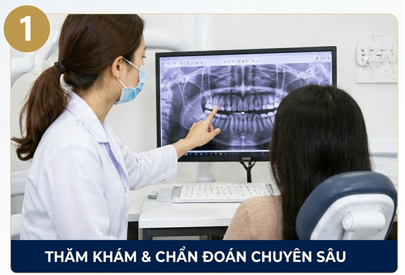 Quy trình niềng răng cắn ngược