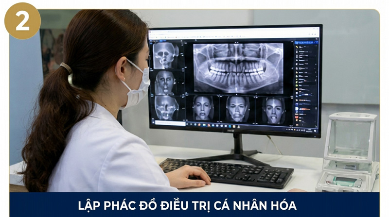 Quy trình niềng răng cắn ngược